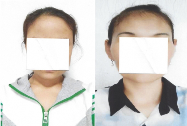 수잔 숄티 대표는 이날 청문회에서 문재인 정부의 탈북자 인도거부로 인해 중국 인신매매단에 다시 잡히게 된 두 명의 여인의 사진을 들어보였다.