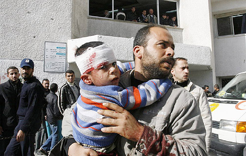 이스라엘의 팔레스타인 폭격에 머리를 다친 아이를 아버지가 안고 있다. ⓒ美 월드비전