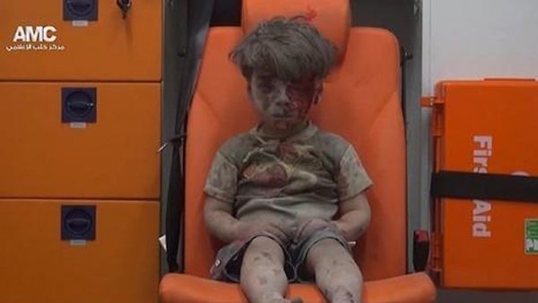 알레포에서 구조된 남자 아이. ⓒAMC 영상캡쳐 